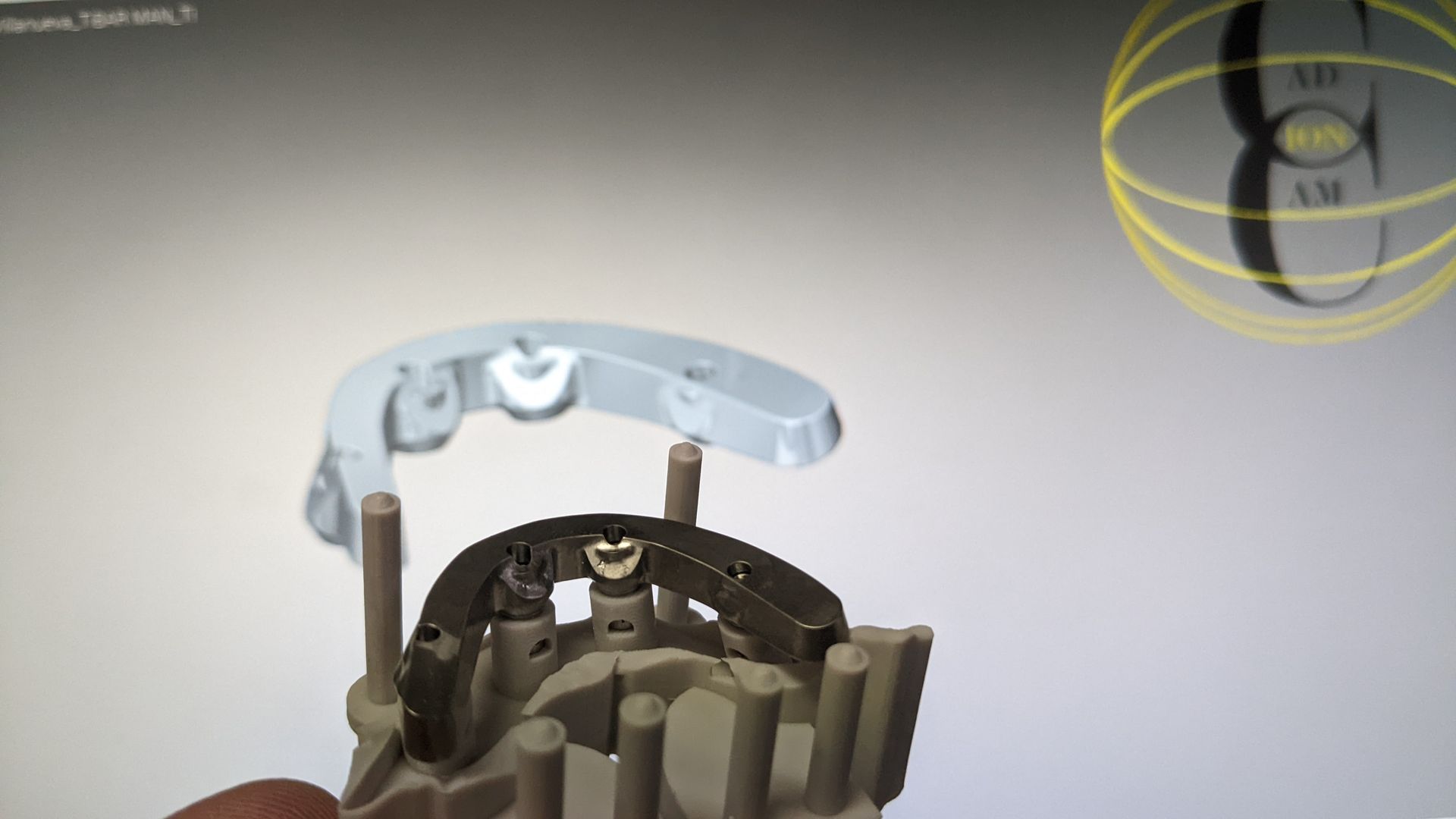 Titanium bar for Hybrid Denture