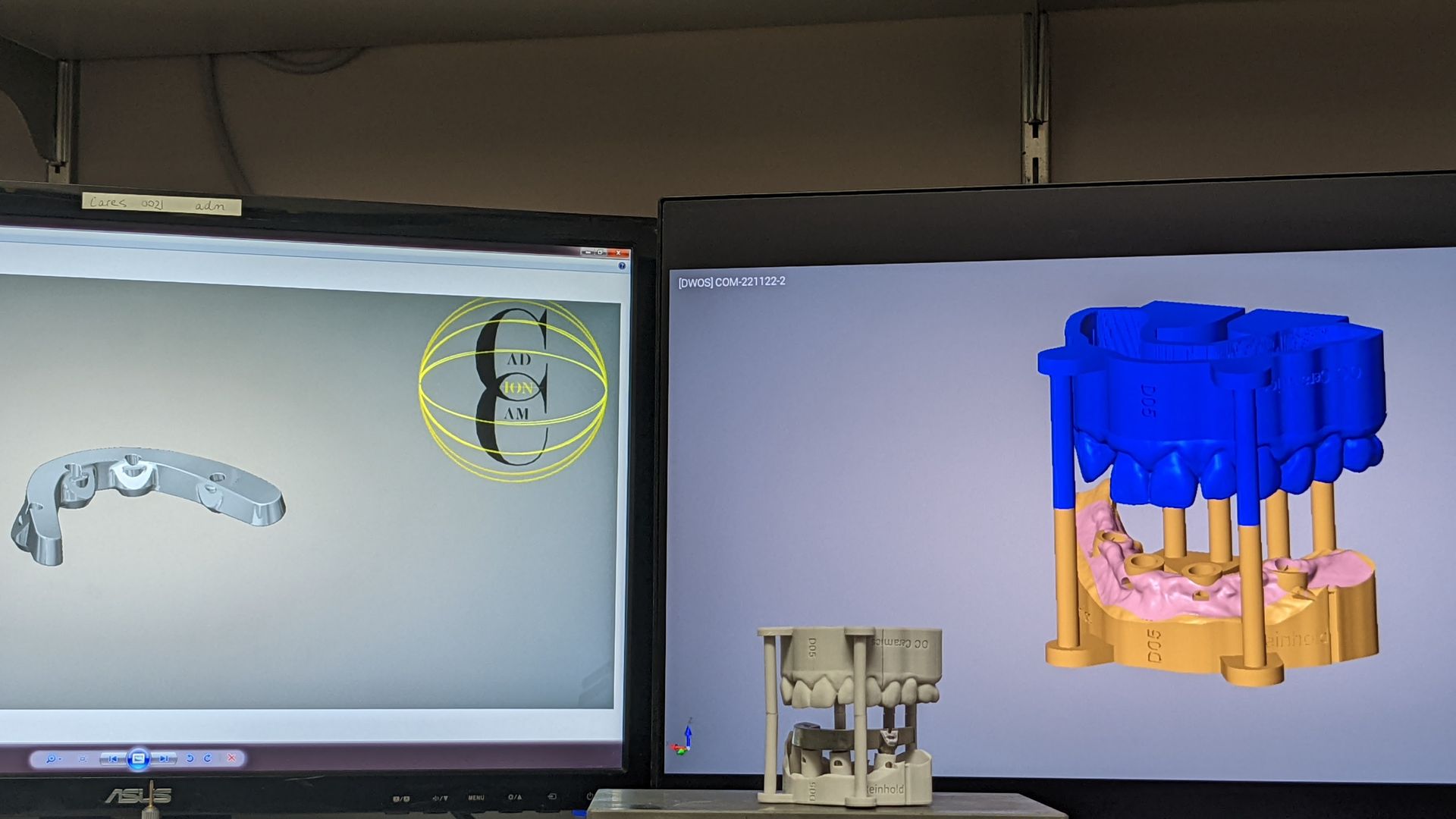 Titanium bar for Hybrid Denture