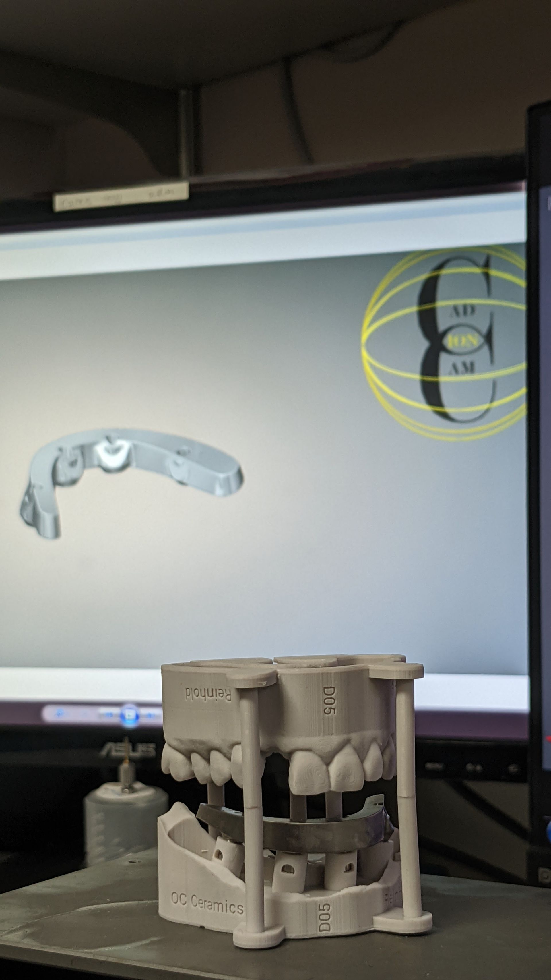 Titanium bar for Hybrid Denture