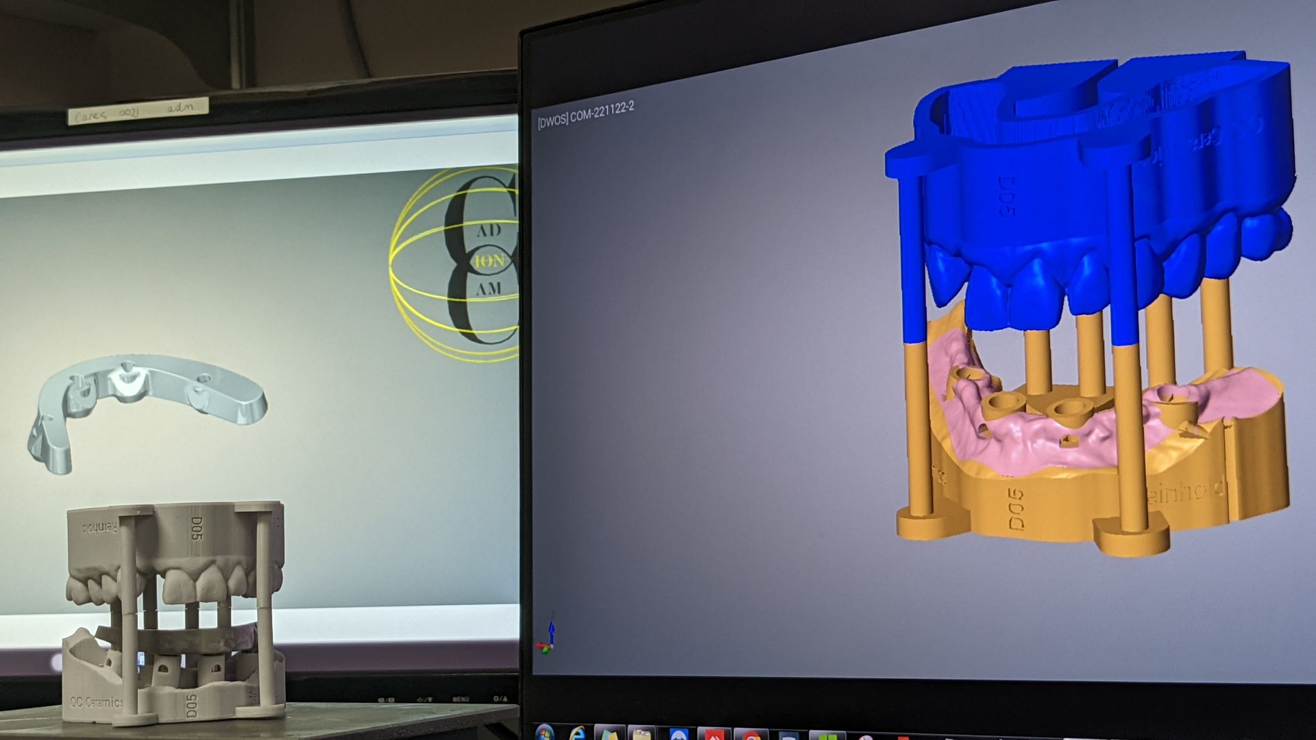 Titanium bar for Hybrid Denture