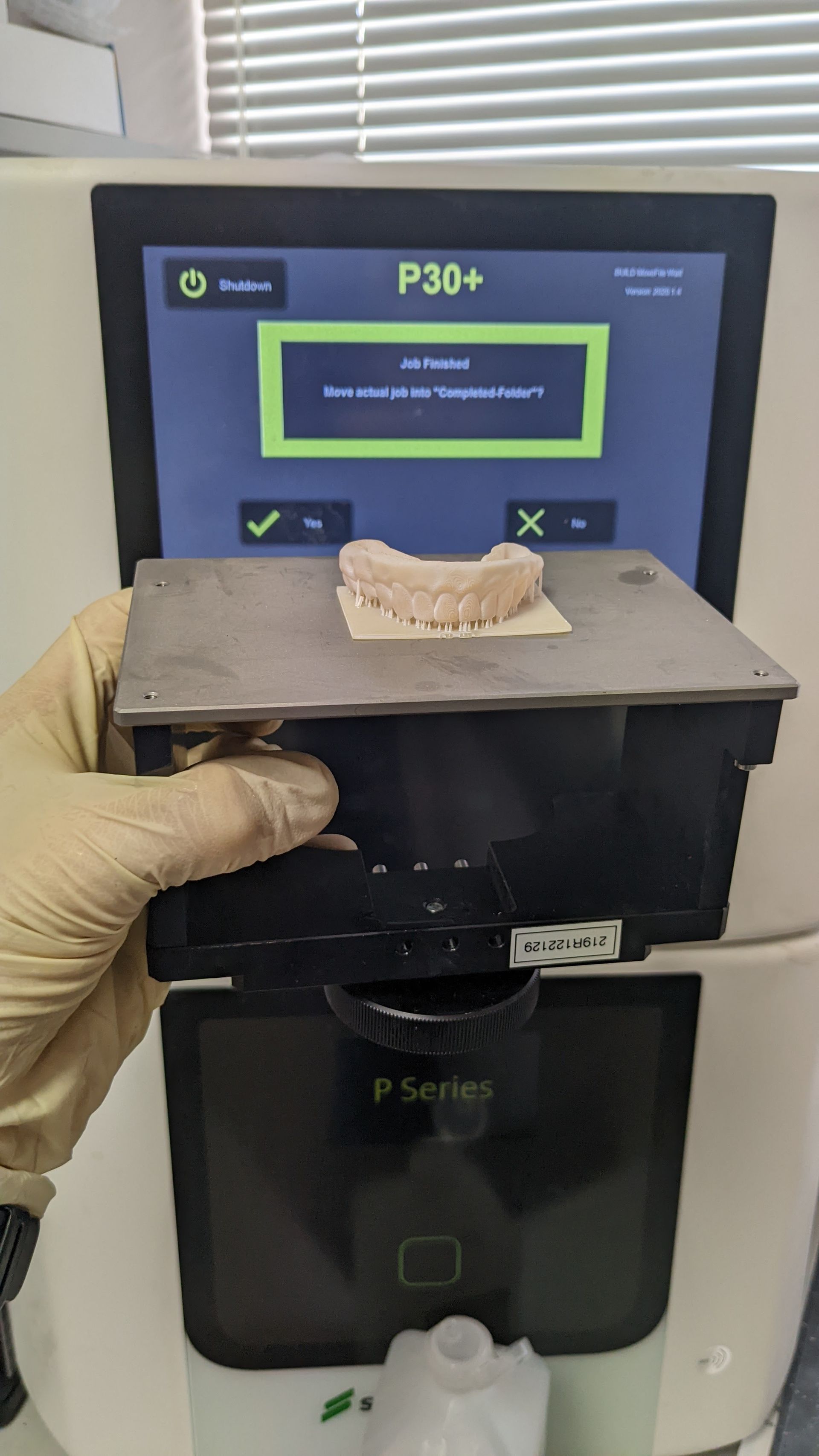 Hybrid Denture 3d Print