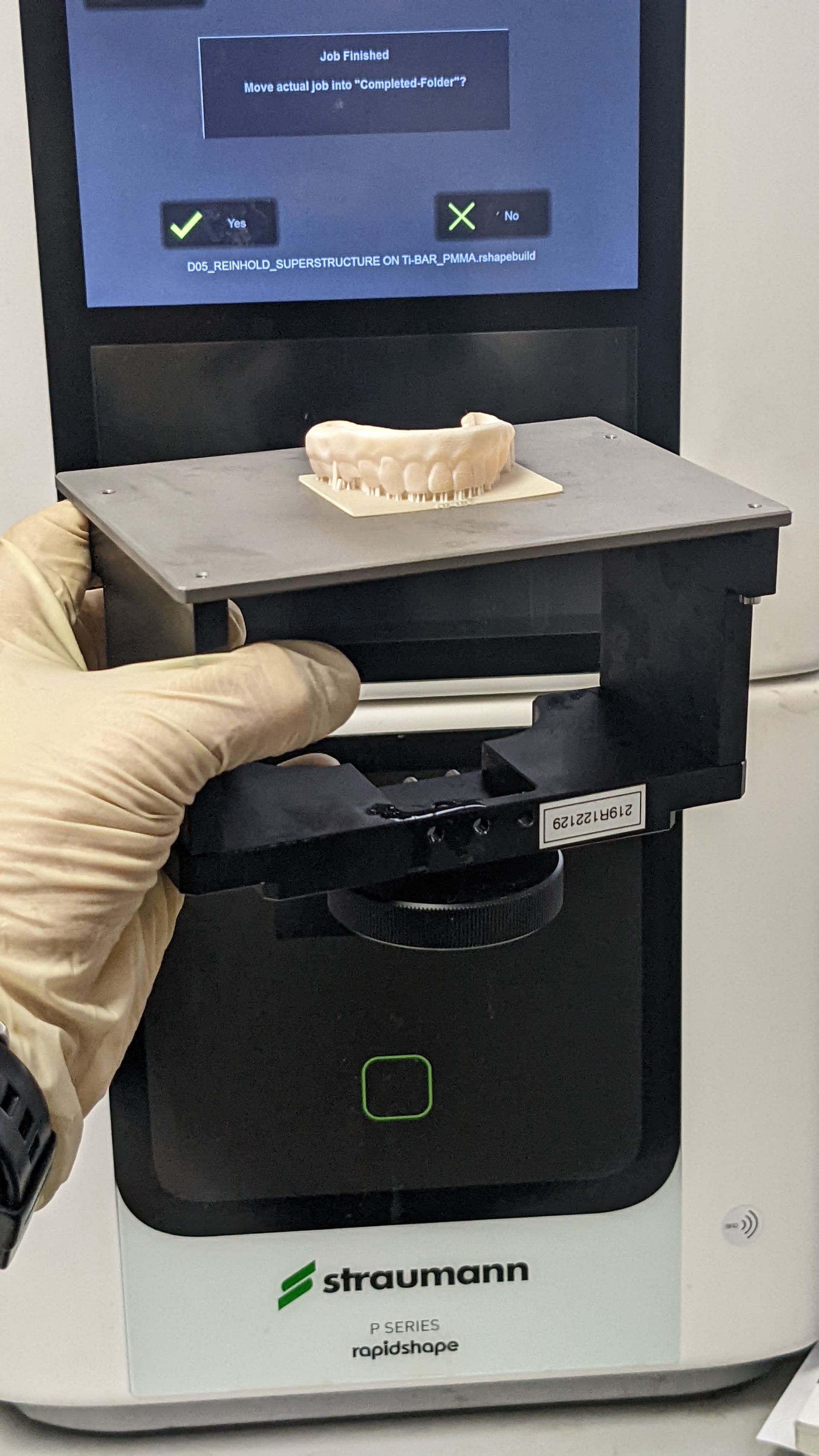 Hybrid Denture 3d Print