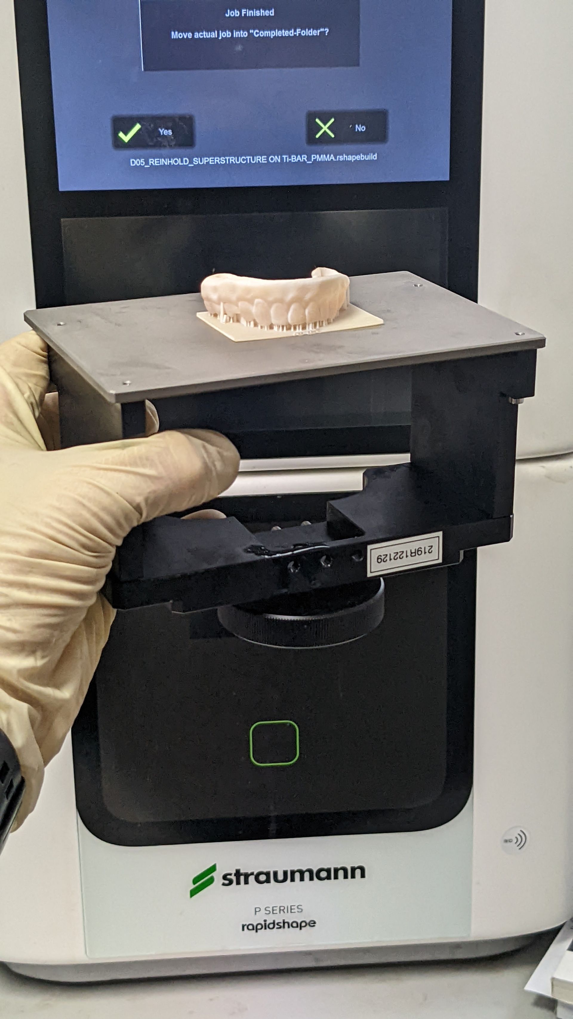 Hybrid Denture 3d Print