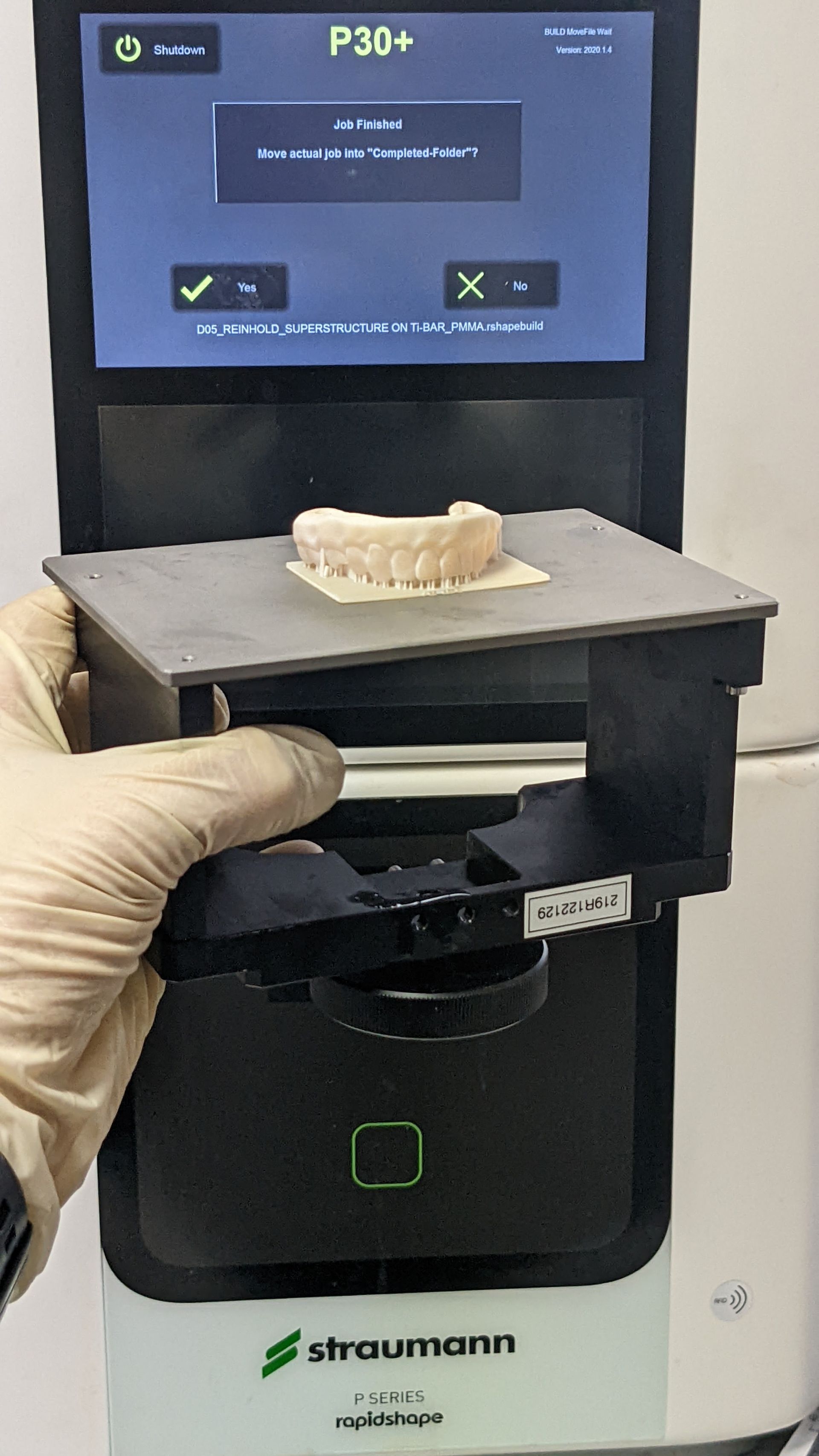 Hybrid Denture 3d Print