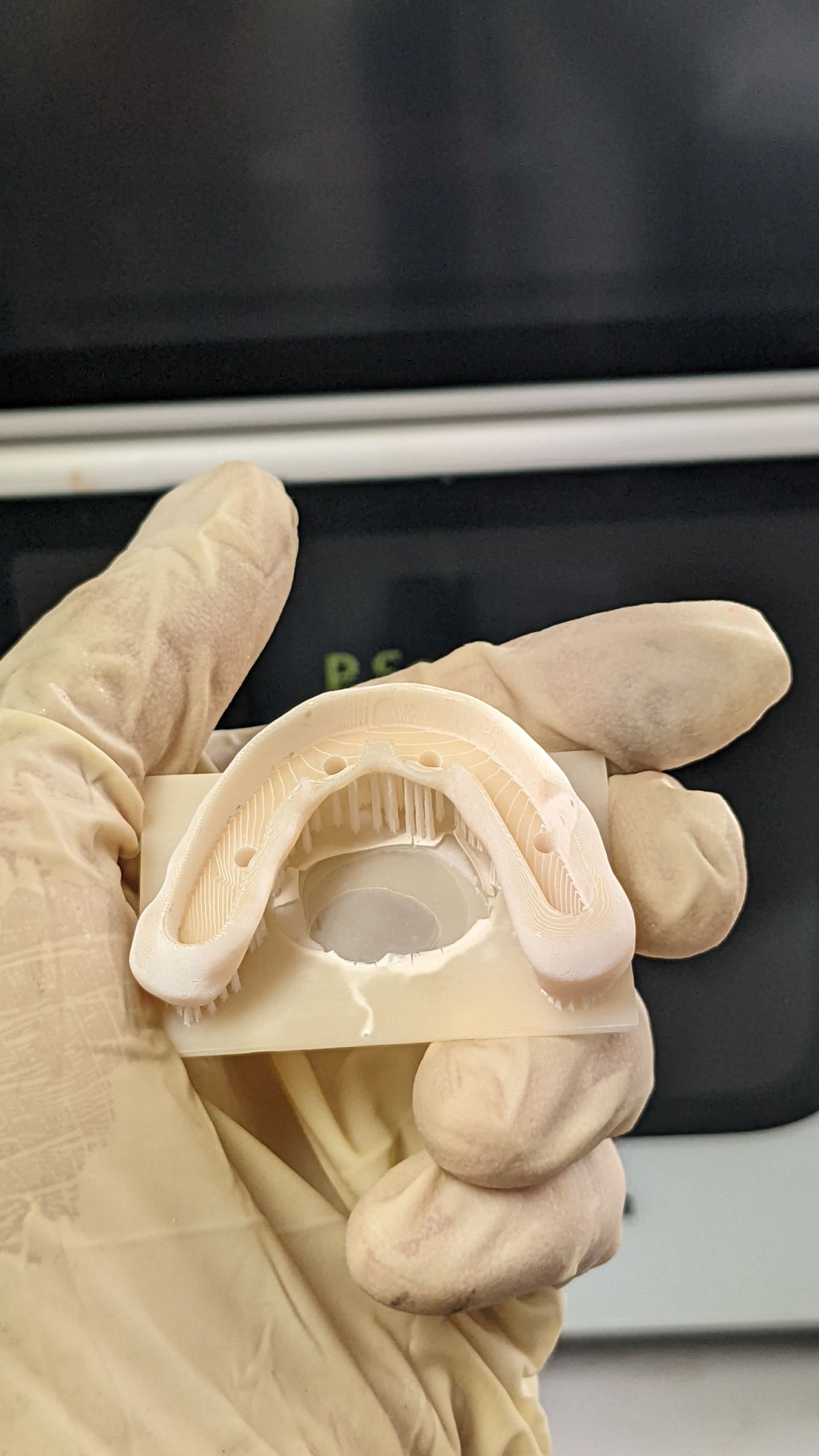 Hybrid Denture 3d Print