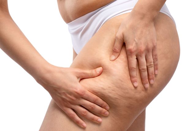 Understanding Tirzepatide: How the Latest Injection Supports Weight Loss
