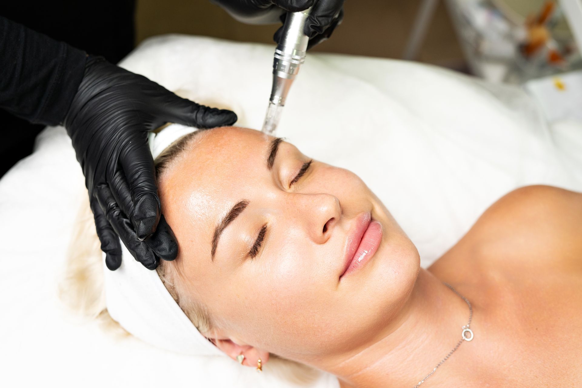 A woman is getting a microdermabrasion treatment on her face.