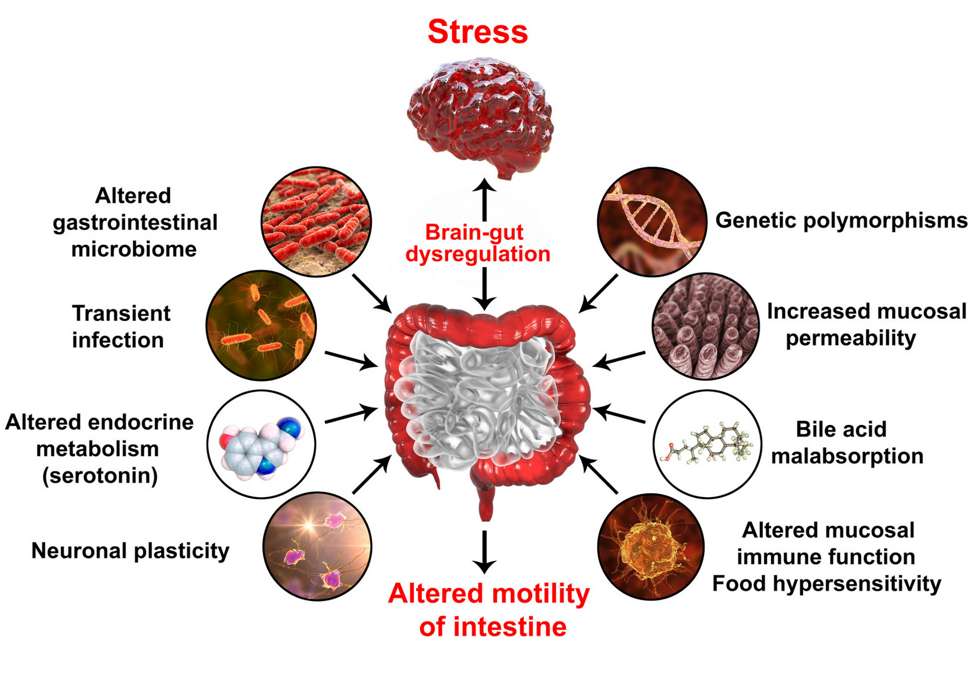 A diagram showing the effects of stress on the intestine