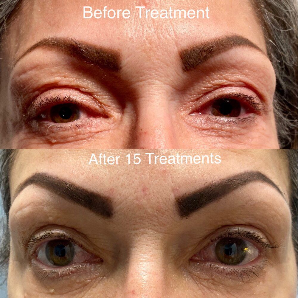 A before and after photo of a woman 's eyes.