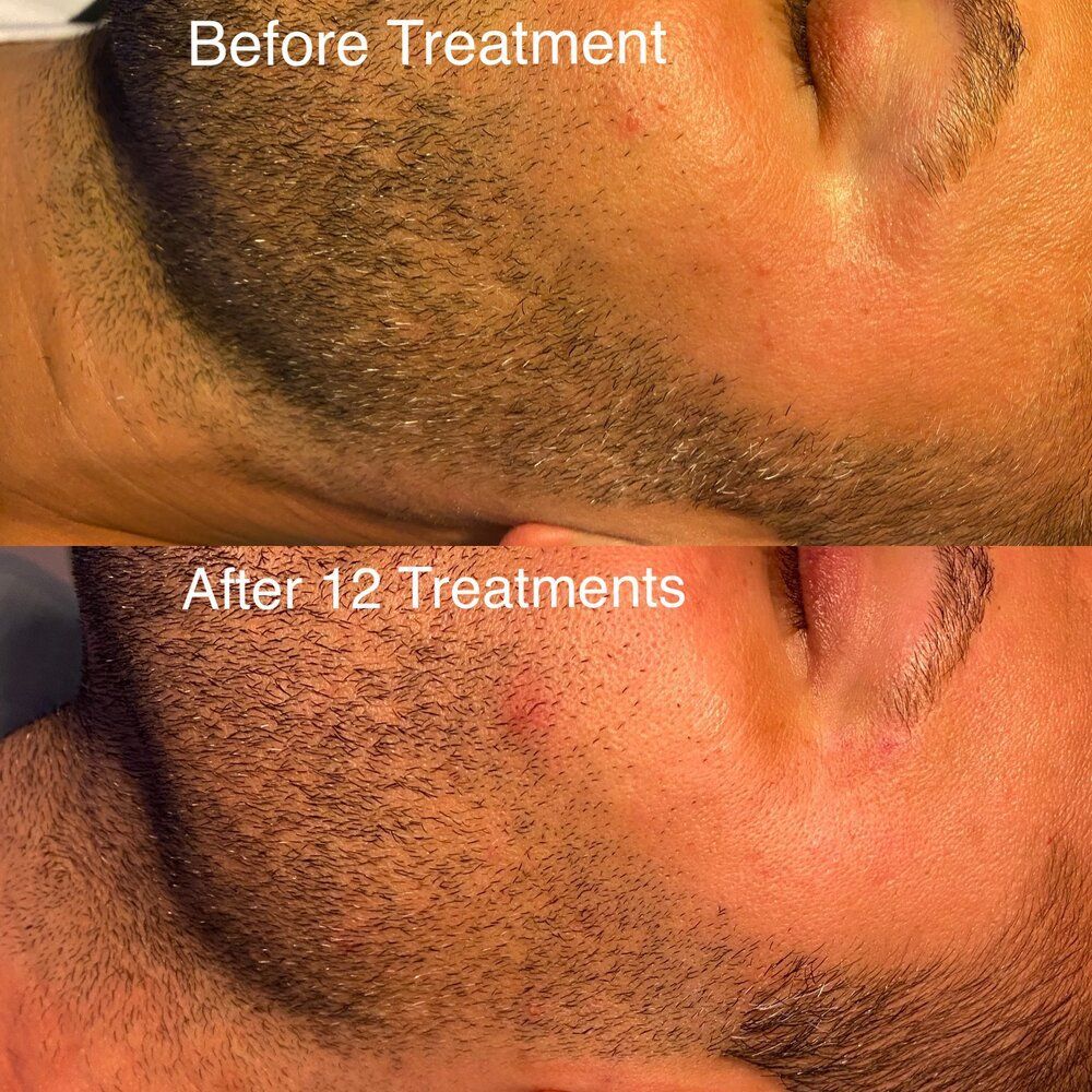 Face Of A Man — Oakbrook Terrace, IL — Prosperian Integrative Clinic