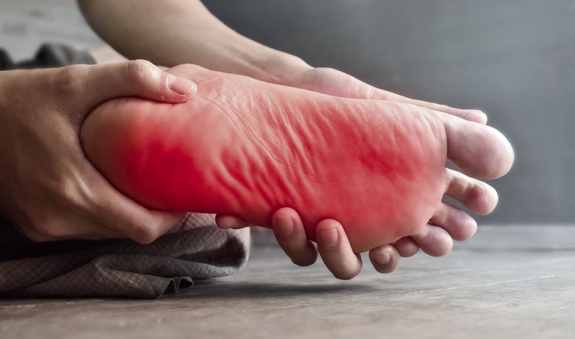 Hands holding a foot with red, inflamed sole indicating pain or irritation.