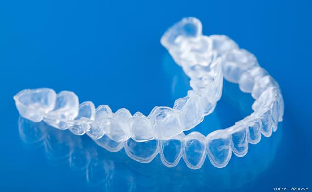 Home-Bleaching: Folien, in die das Bleaching-Gel eingefüllt wird und die anschließend über die Zähne gestülpt werden