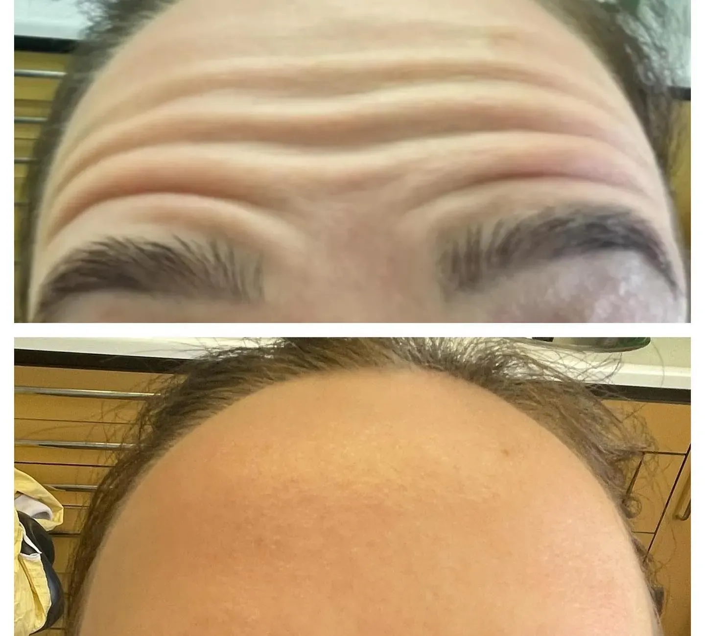 Face - Before & After