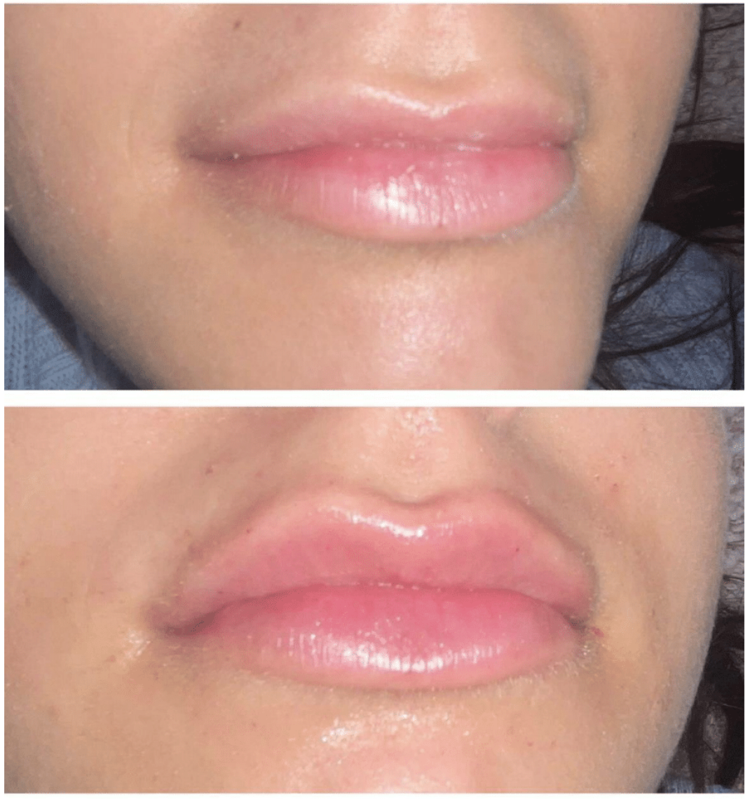 Facial Aesthetics