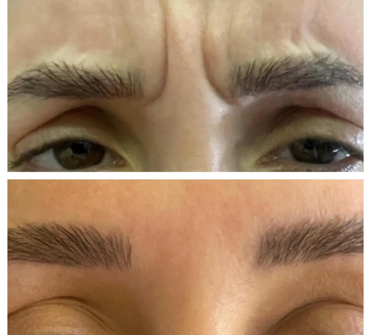 Face - Before & After