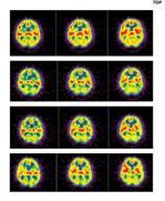A row of images of a brain with different colors on a black background.