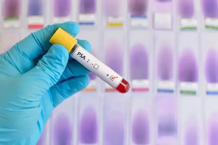 PSA exame