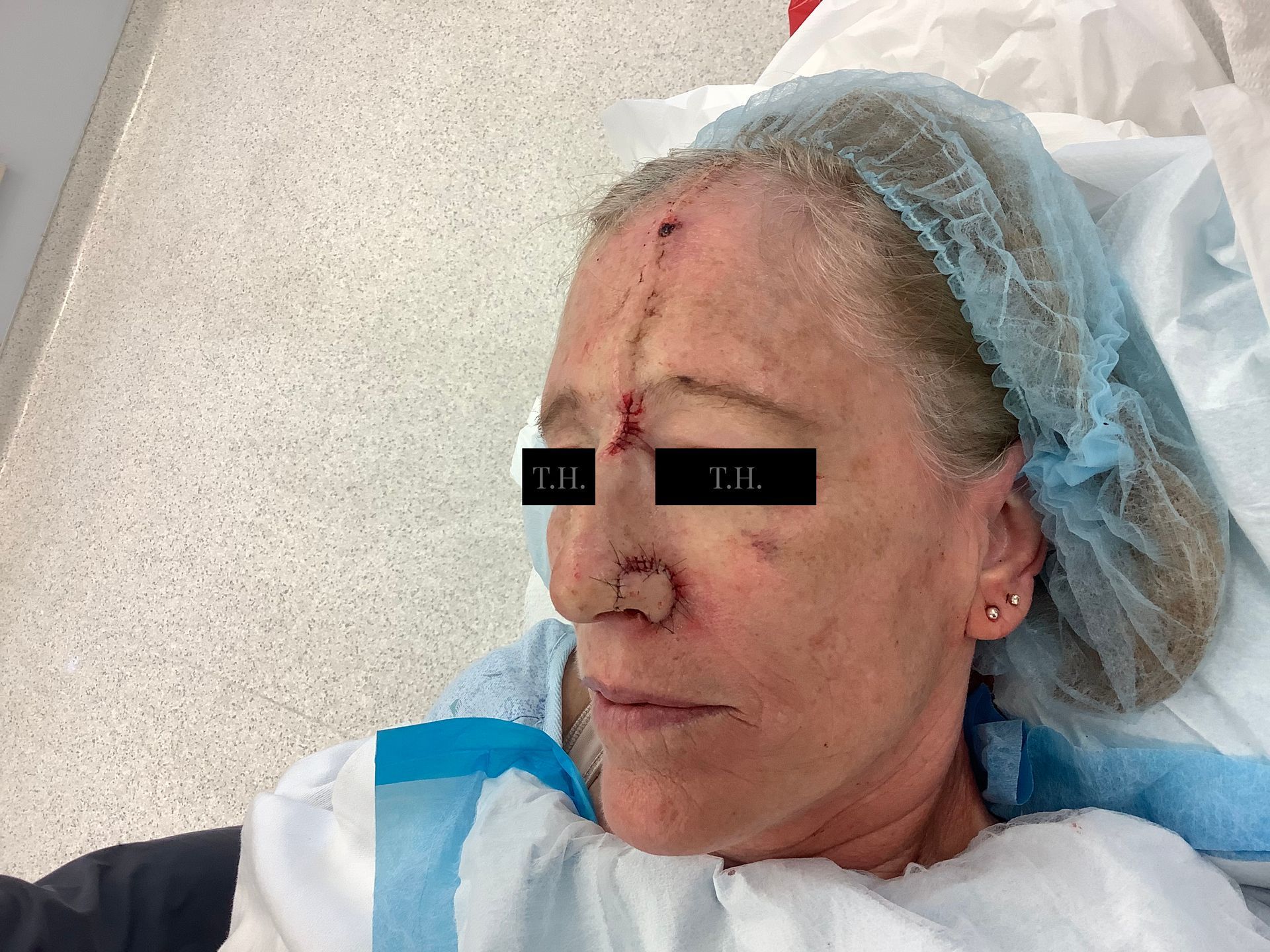 A close up of a woman 's face with a window in the background