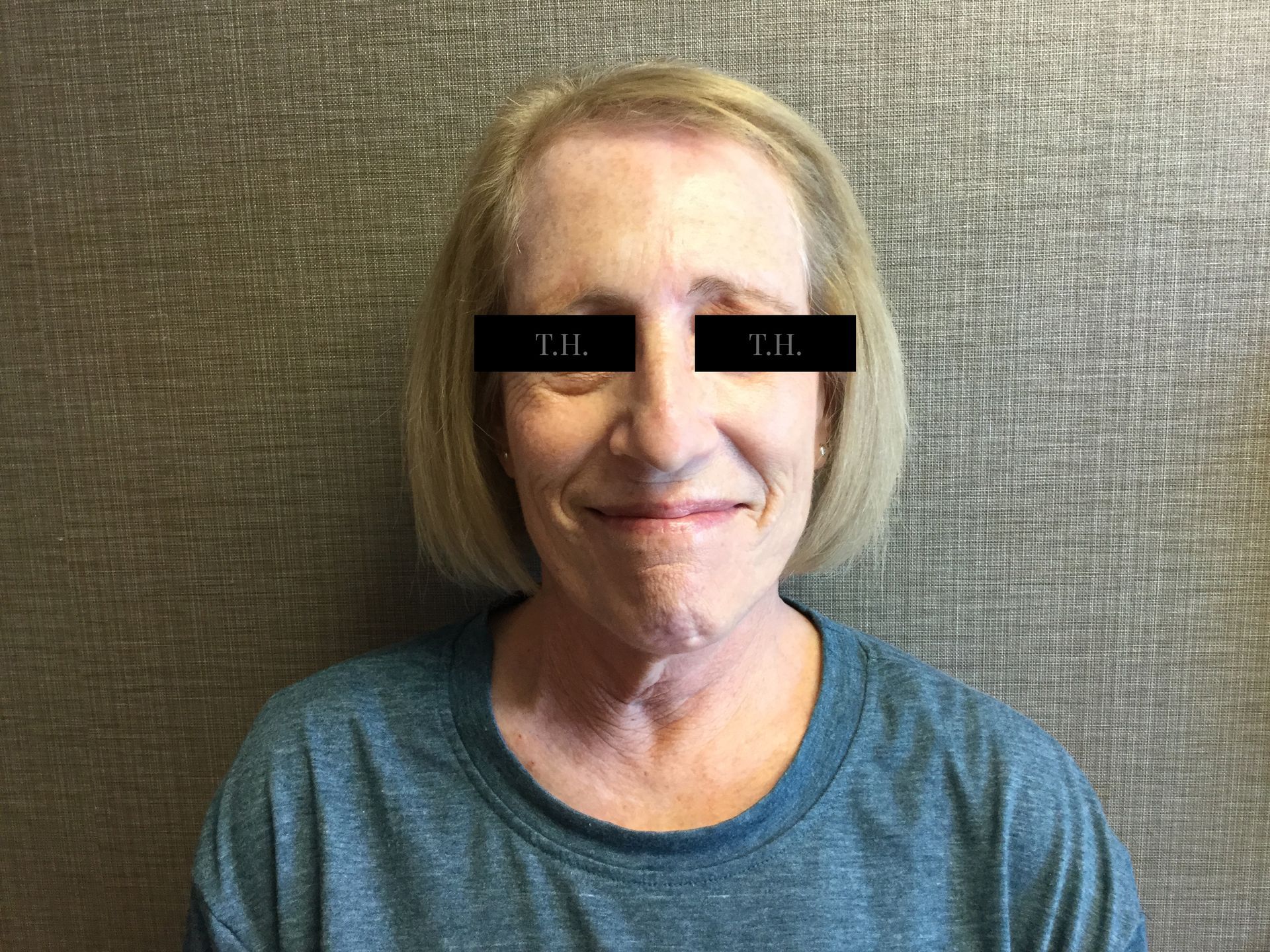 A woman in a blue shirt is smiling with a pair of black glasses on her eyes.