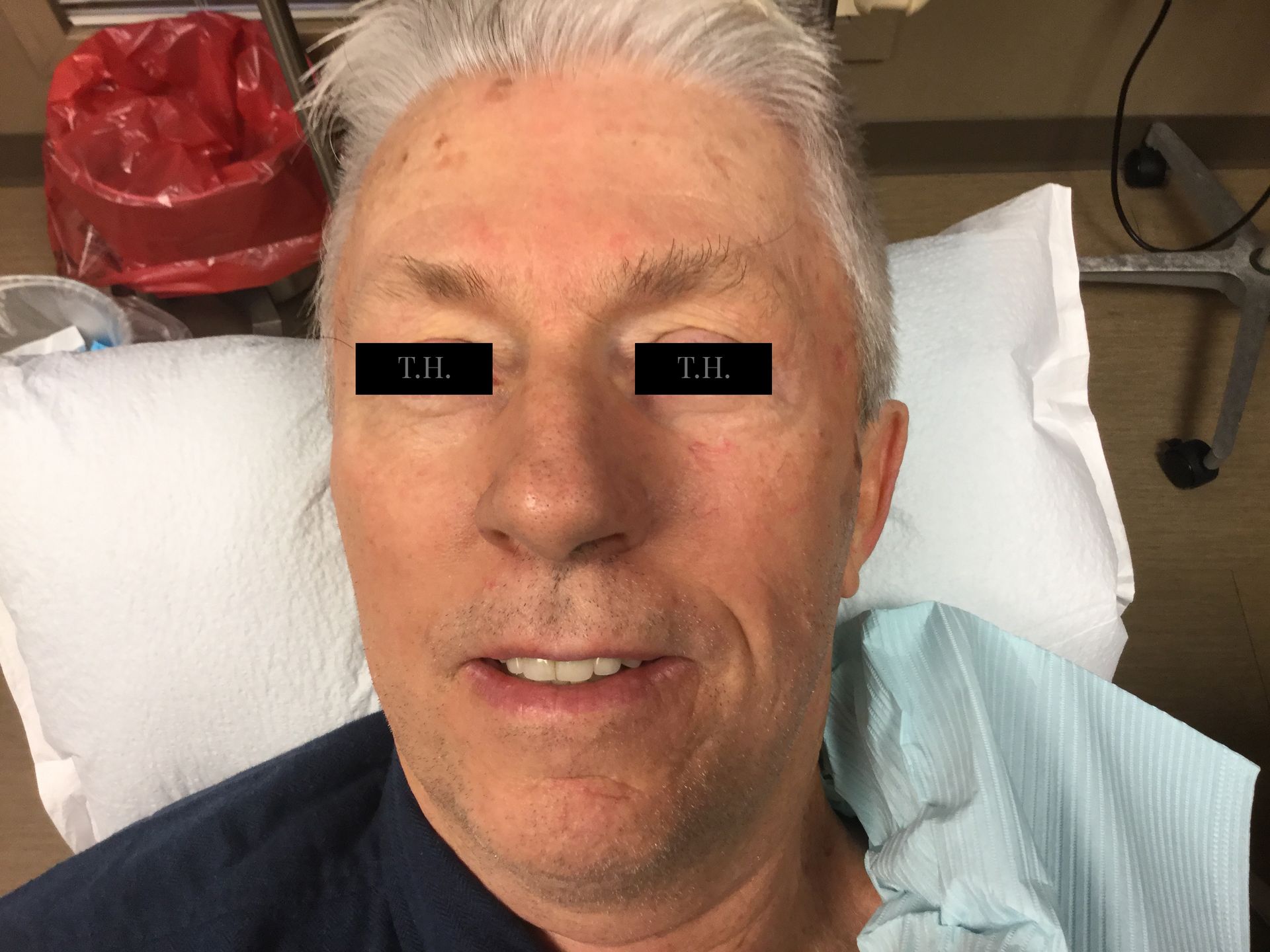 A man is laying in a hospital bed with his eyes closed.