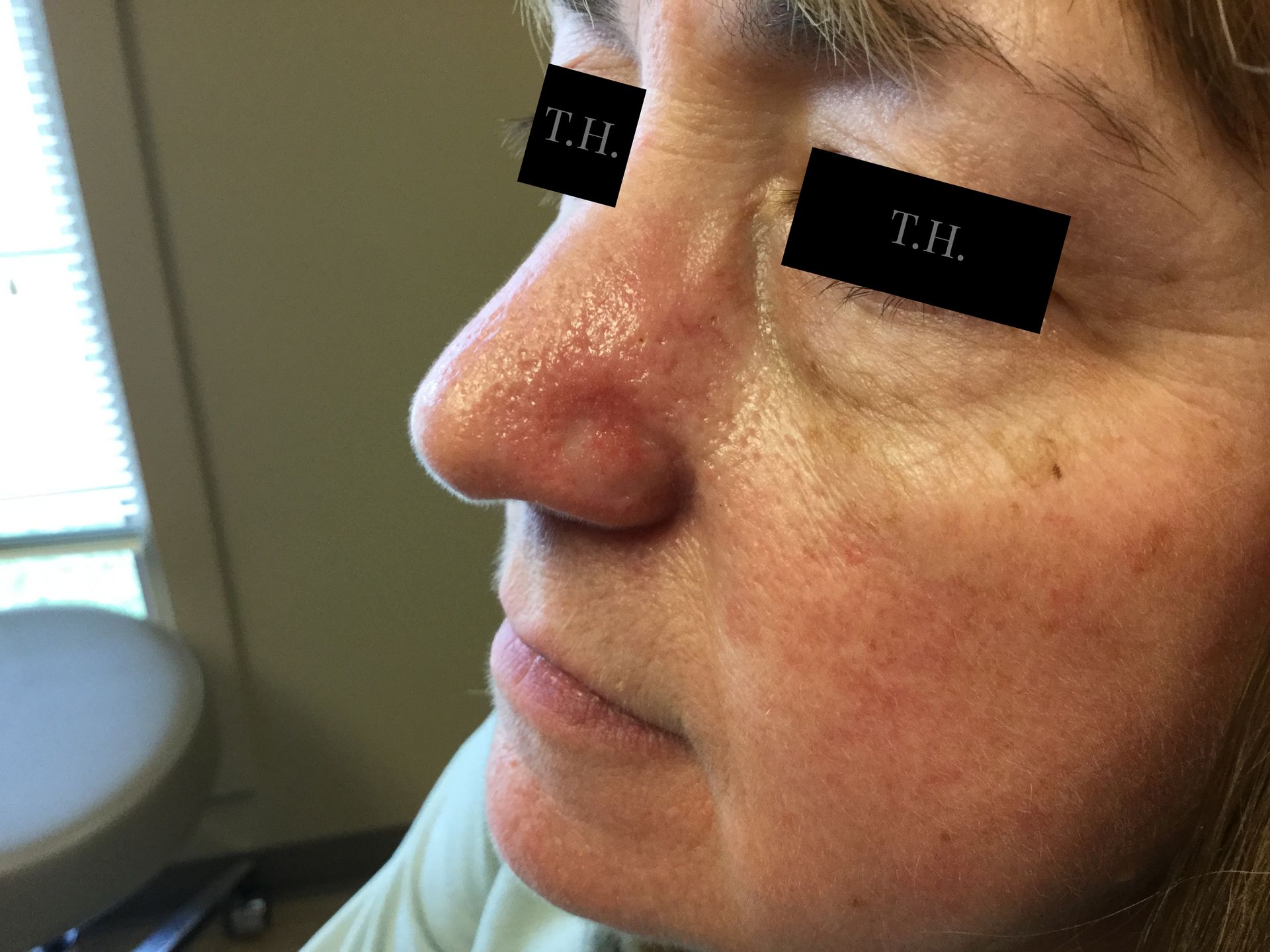 A close up of a woman 's face with a red nose.