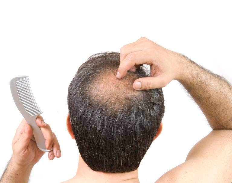 A man is brushing his hair with a comb