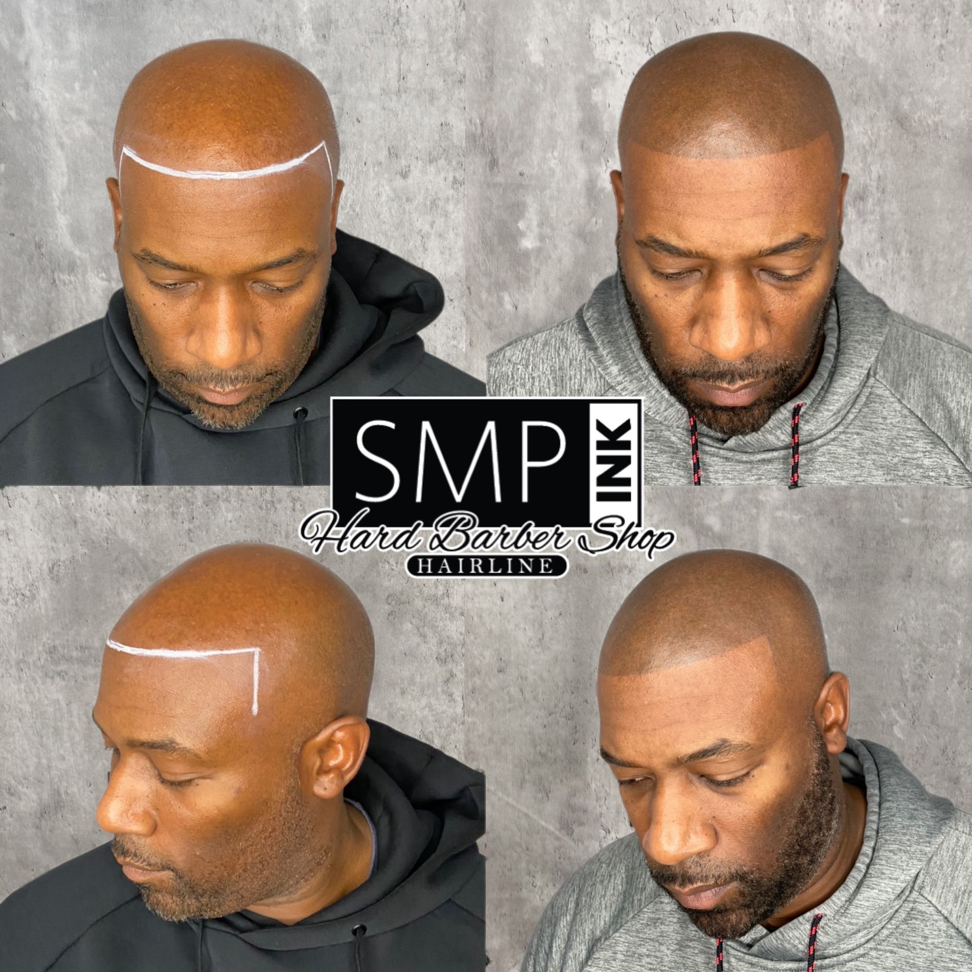 Male Client journey though SMP Treatment