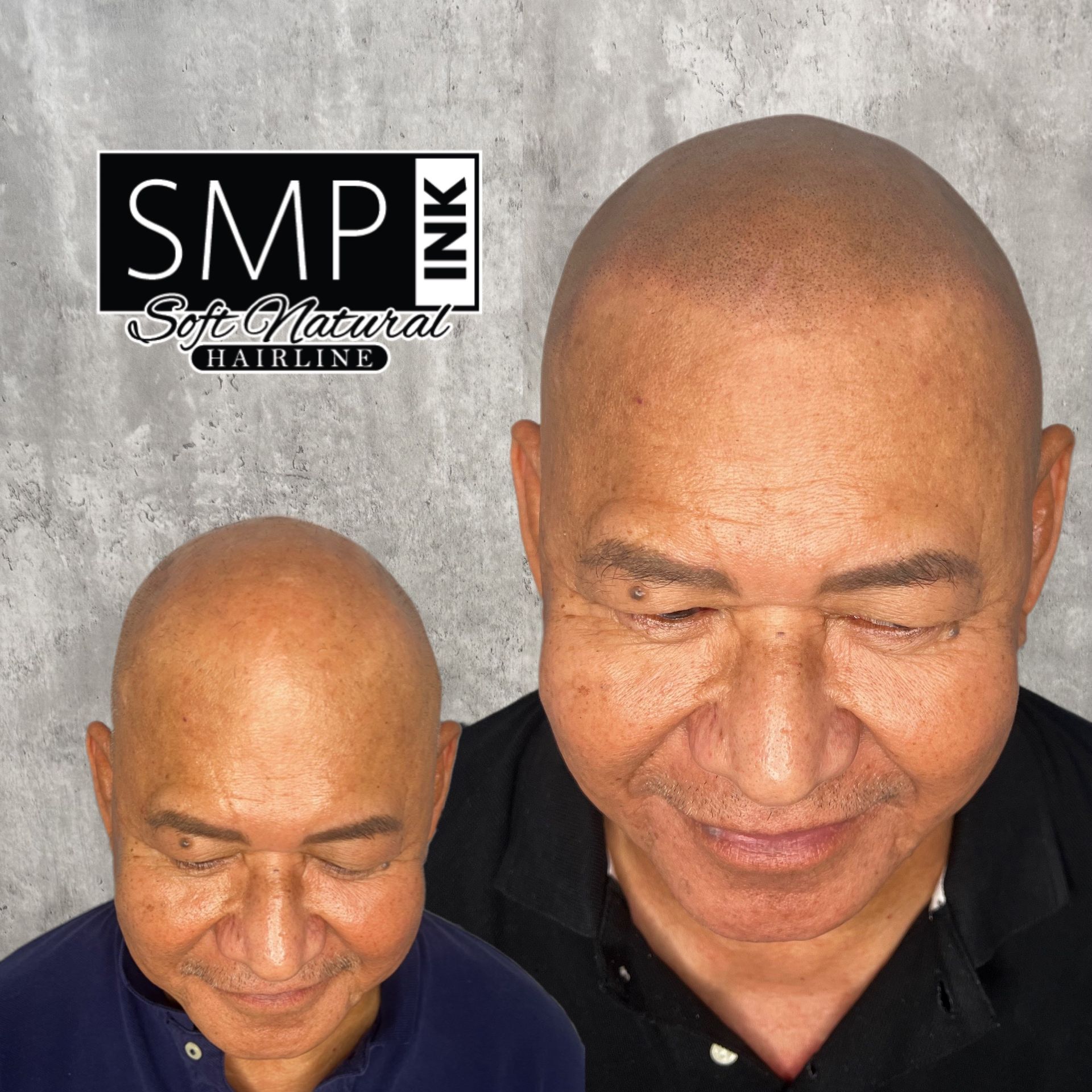 SMP Inc CDA before and after