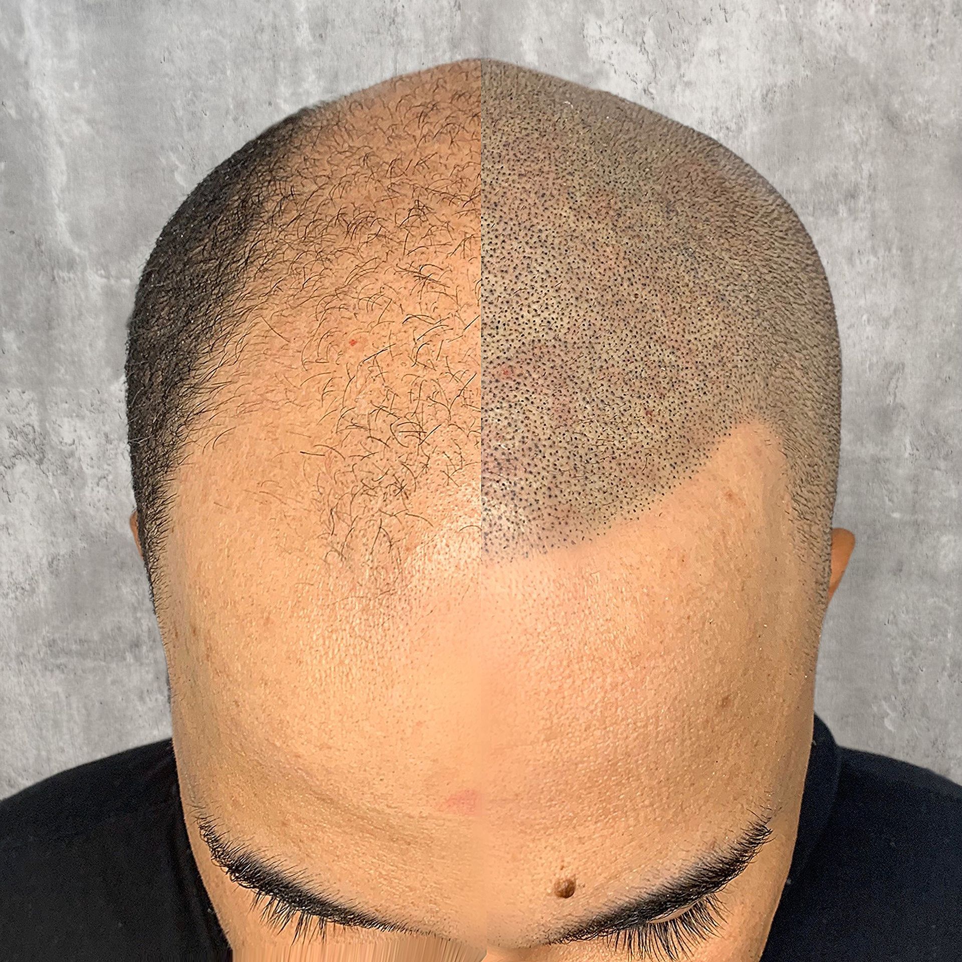 A close up of a man 's head with half of his hair shaved.