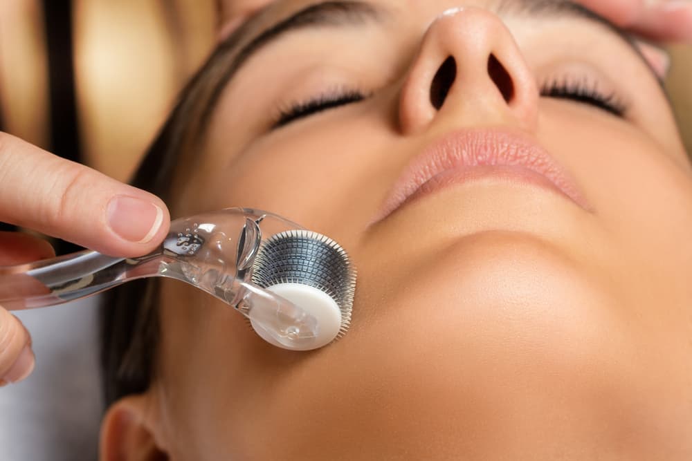 Derma Skin Roller on Face - Holistic Skincare In Shell Cove, NSW