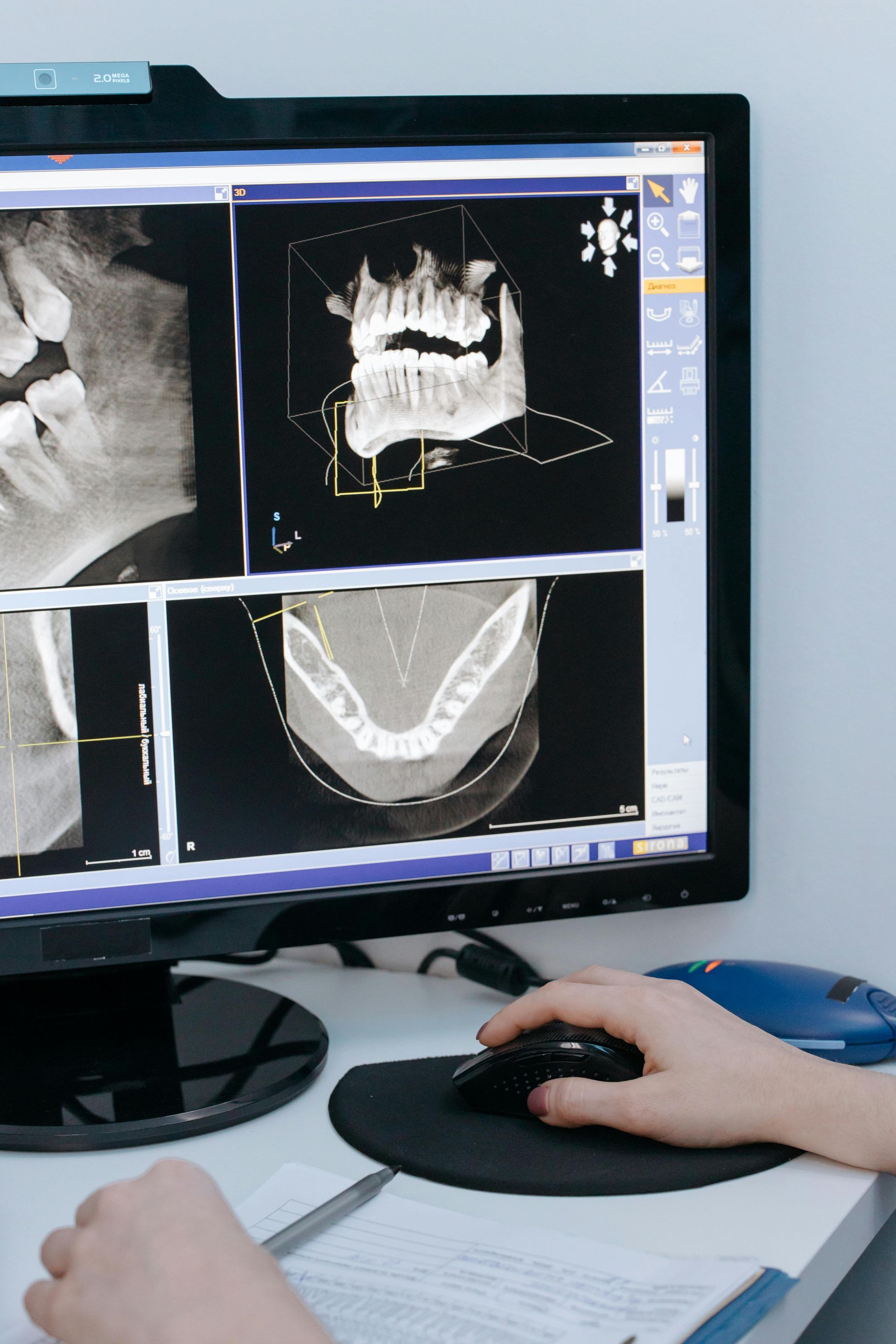 A person is using a computer to look at a dental x-ray.