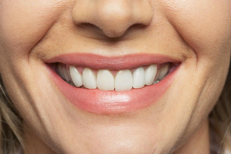 Woman's Smile — Orange, CT — New England Dental Health Services PC