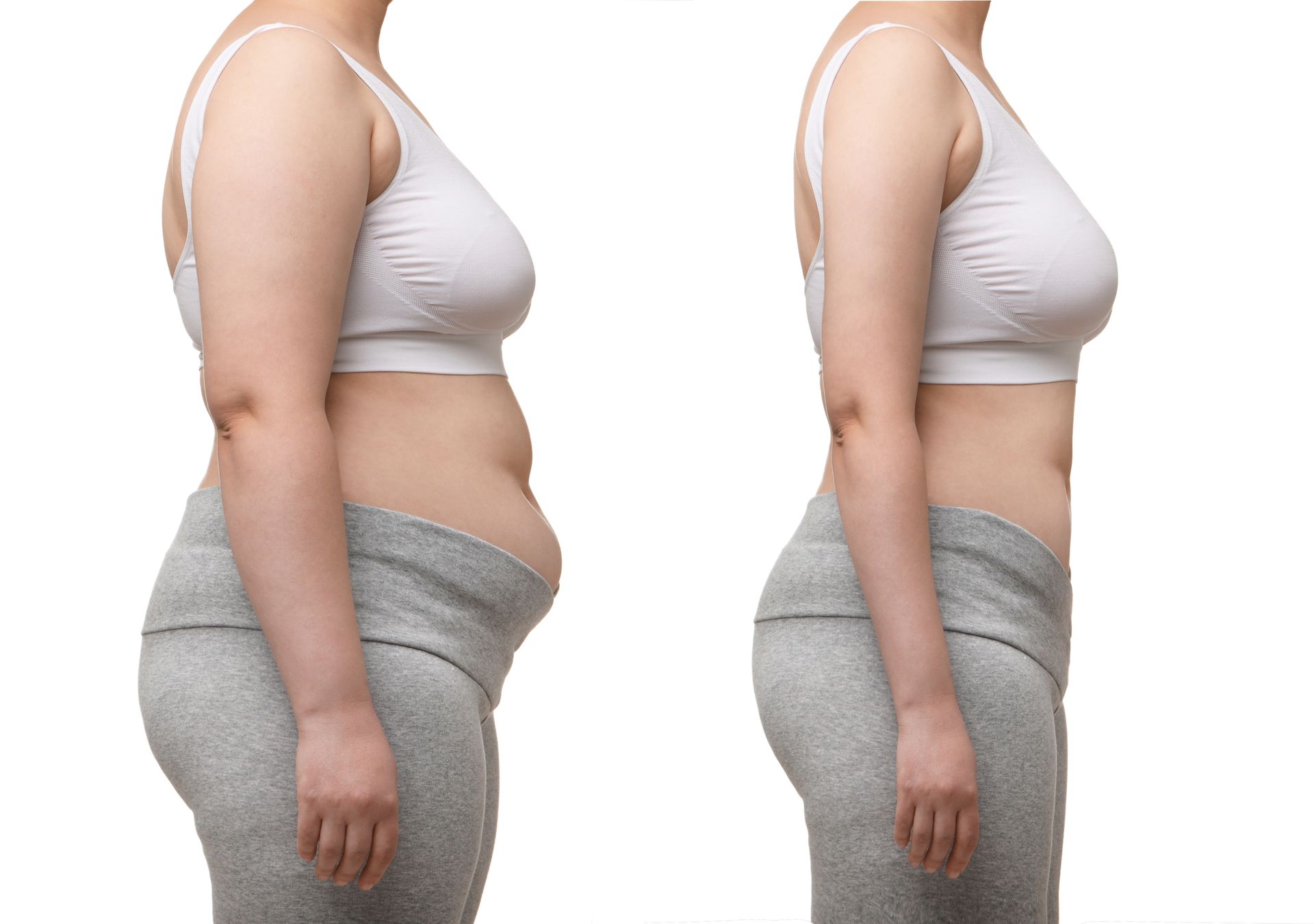stock-photo-collage-with-photos-of-woman-before-and-after-weight-loss-on-white-background-closeup-2478532485-2880w