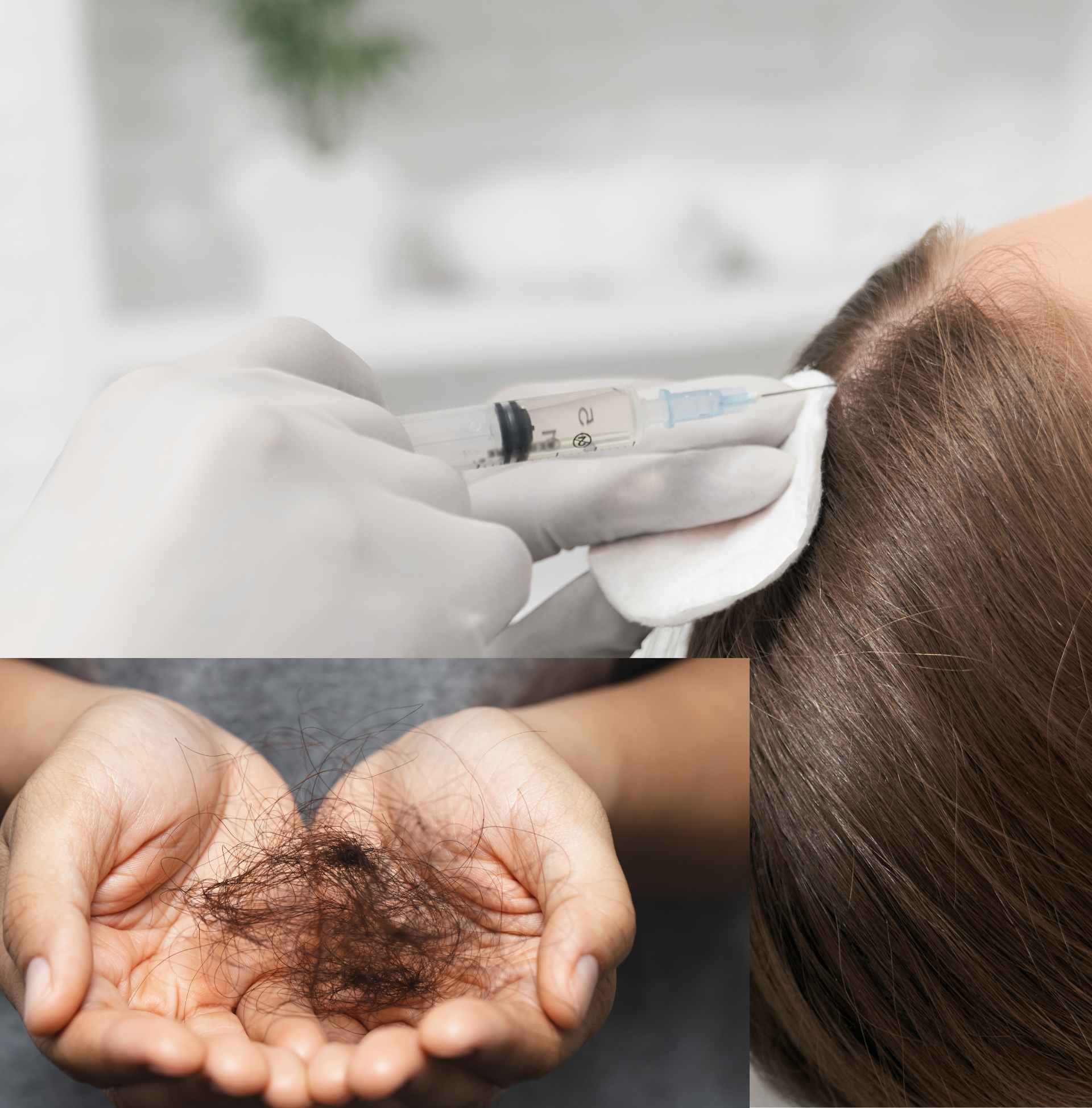 A woman getting an injection in her scalp for hair loss