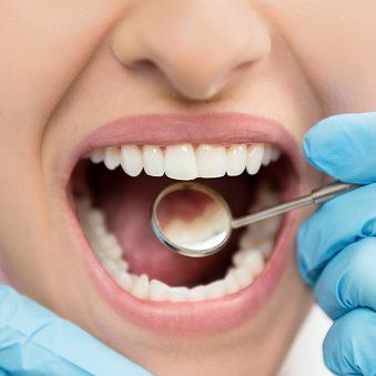 inspection of teeth
