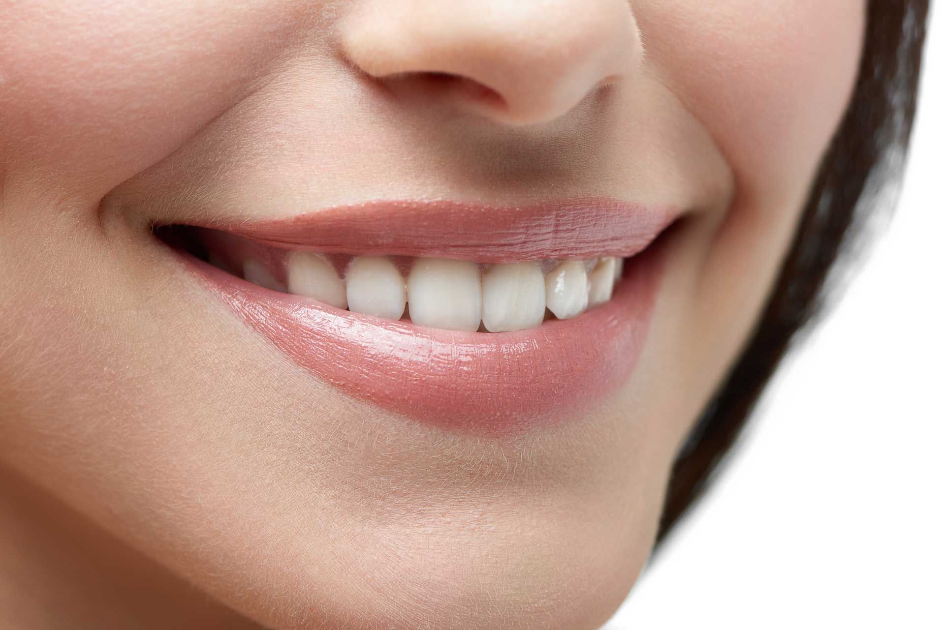 Close-up of a model’s smile showcasing cosmetic dentist care for bright, flawless teeth.