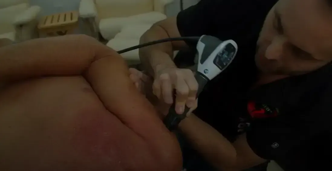 Person receiving treatment on their back, as another person uses a device on the skin.