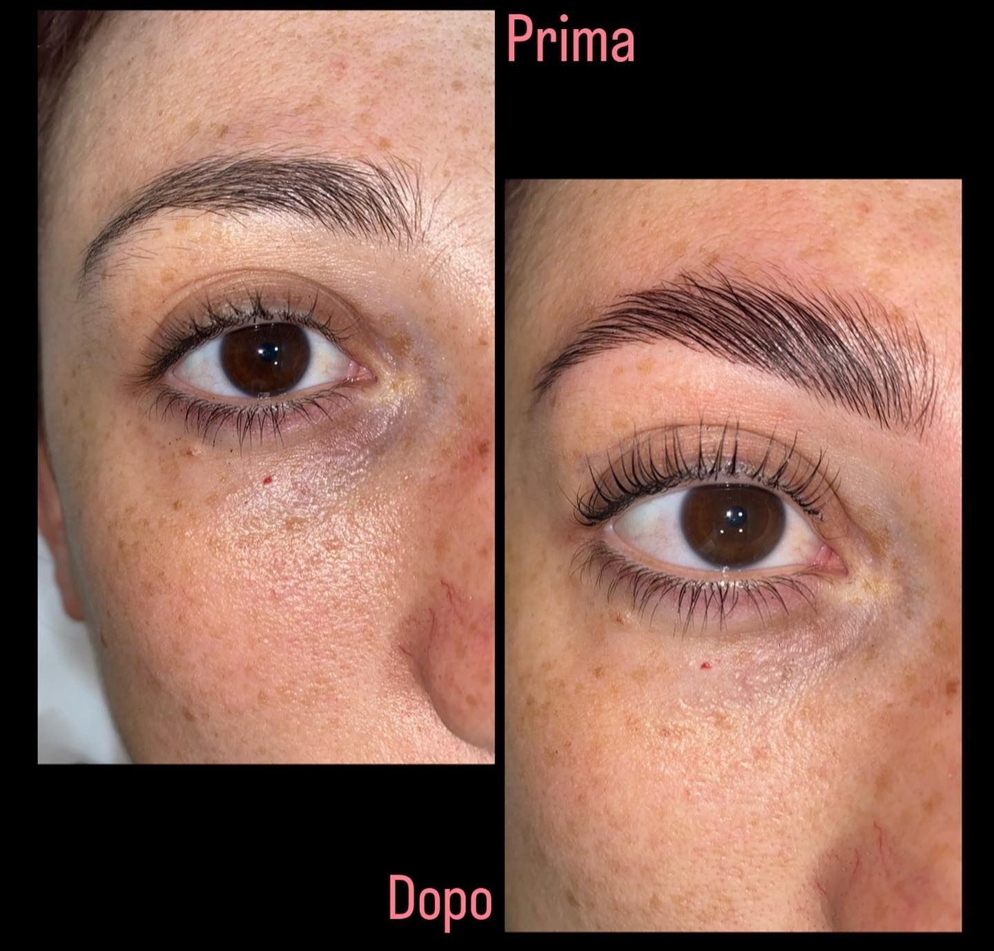 Prima e dopo di un occhio con sopracciglia rade. Dopo: sopracciglia riempite e ciglia incurvate.