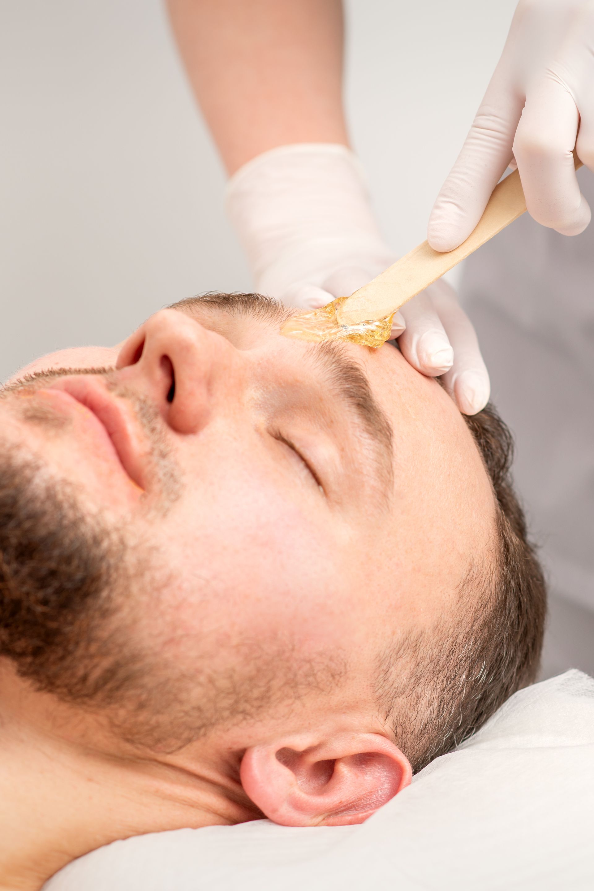 A man with a beard is getting waxed on his face.