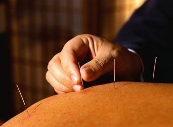 Acupuncture Process — Acupuncture Treatments in Pennsylvania