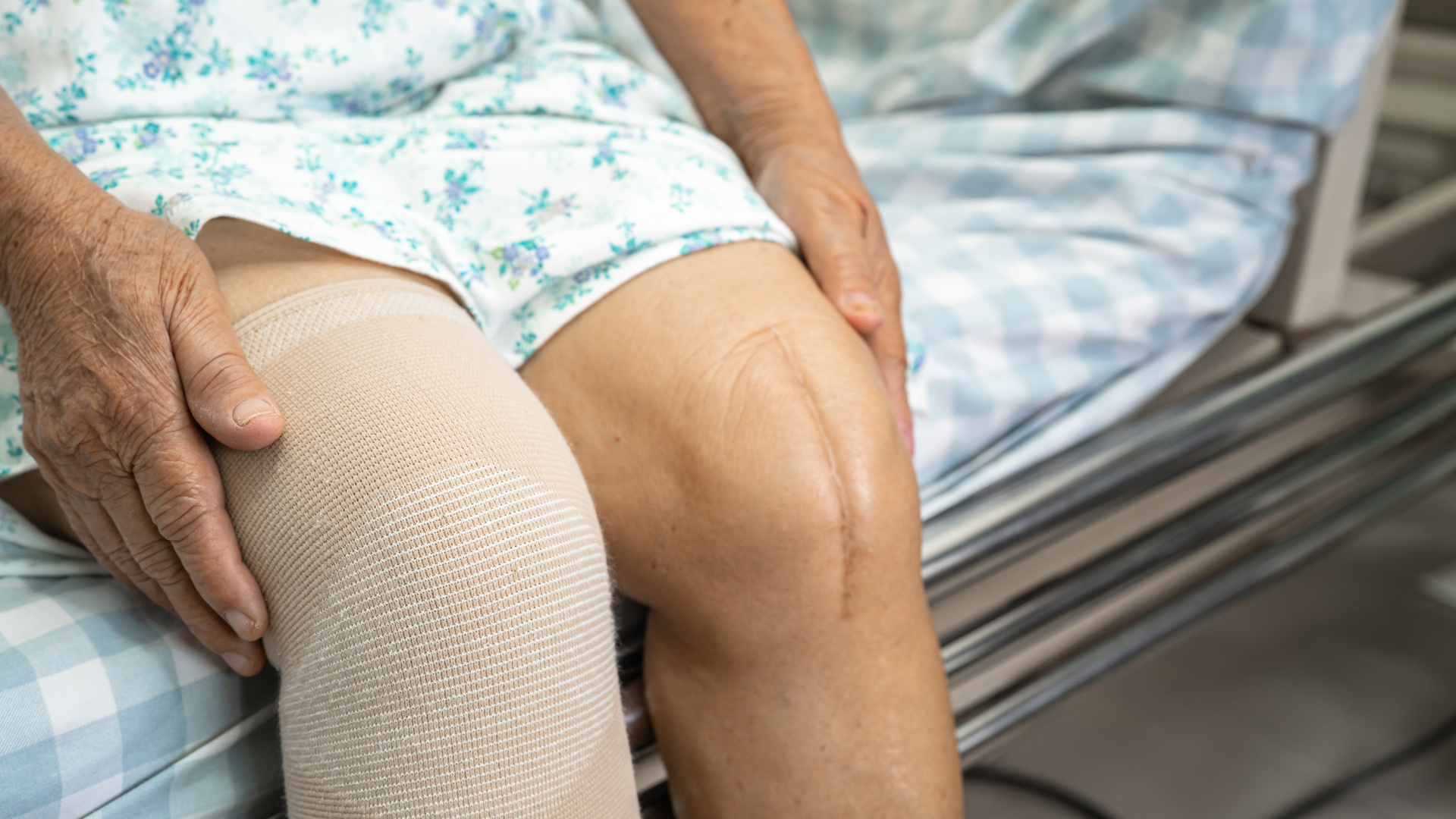 Close-up of an elderly person's legs on a bed. One knee is bandaged; the other shows a surgical scar.