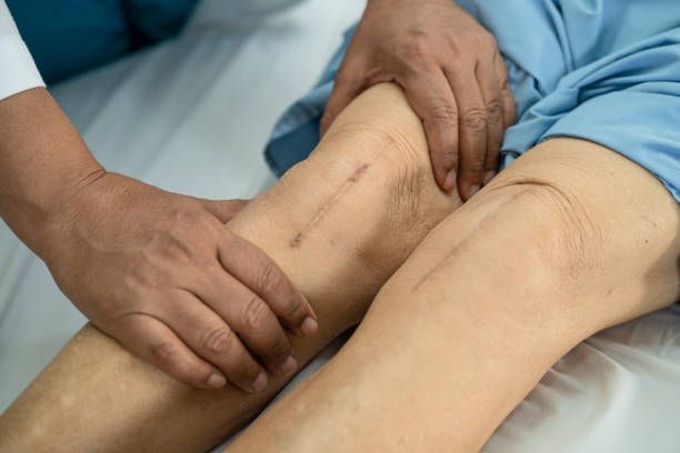 Hands of a person touching the knee of another, showing a scar, likely a post-surgery examination in a medical setting.