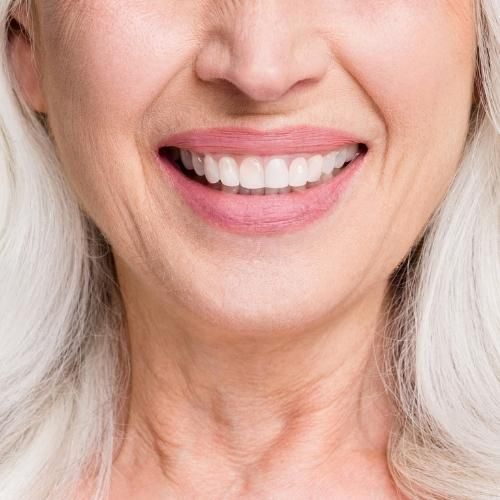Older woman smiling with beautiful teeth