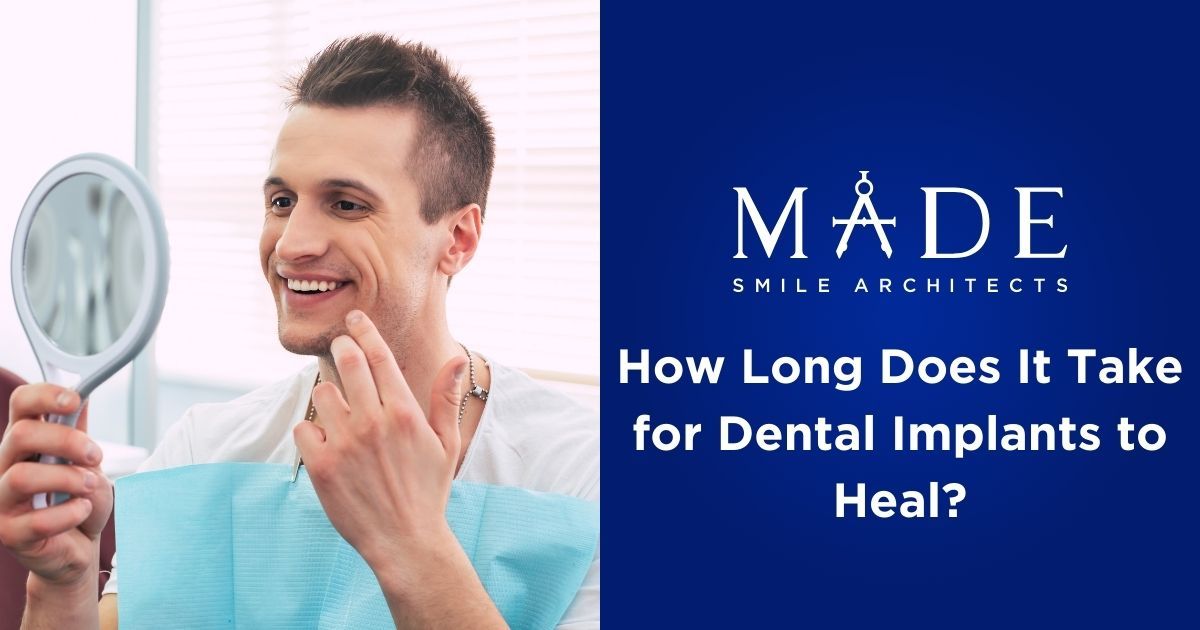 How Long Does It Take for Dental Implants to Heal? | Highland IN