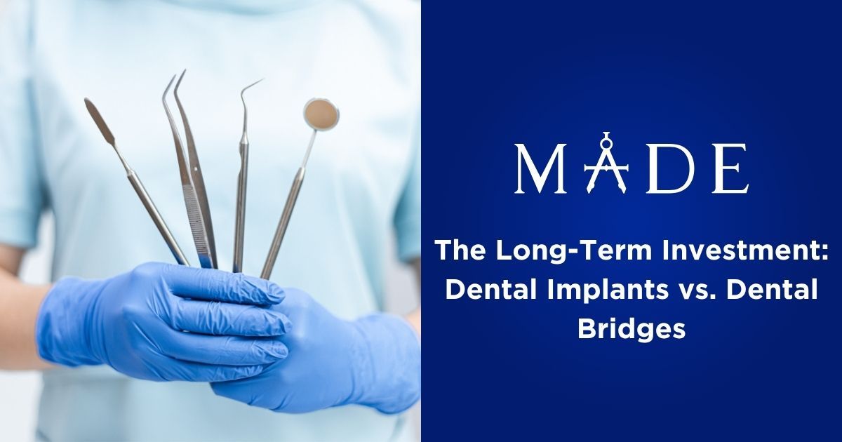 The Long-Term Investment: Dental Implants vs. Dental Bridges