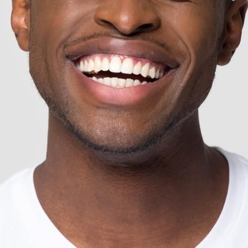 Young man smiling with beautiful teeth