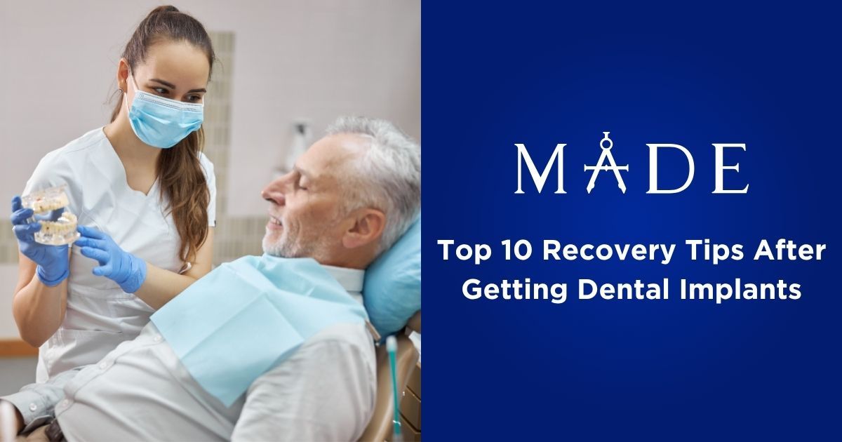 Top 10 Recovery Tips After Getting Dental Implants