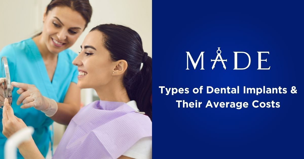 Types of Dental Implants & Their Average Costs
