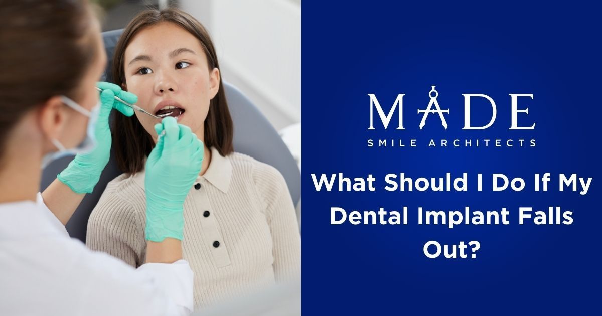 What Should I Do If My Dental Implant Falls Out?