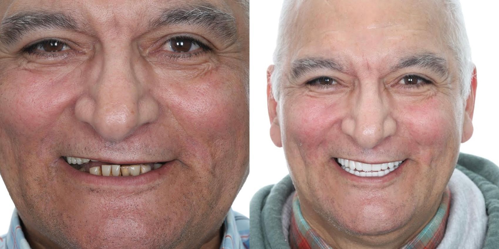 Before and After Molden